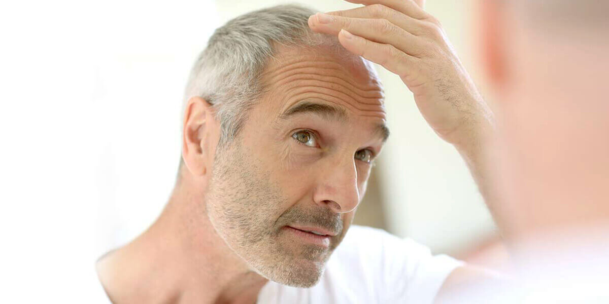 uomo con pochi capelli